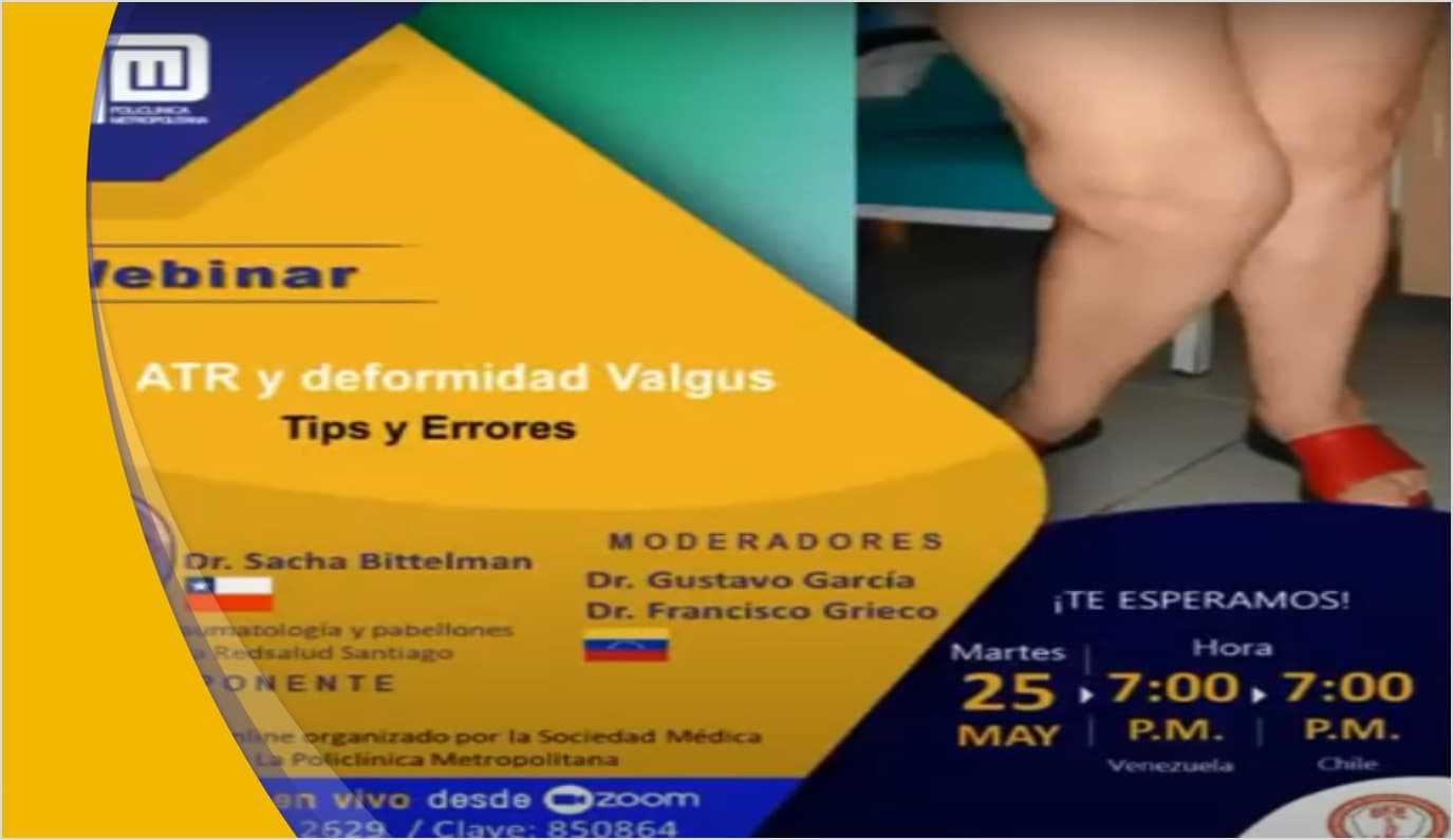 ATR y deformidad Valgus: Tips y Errores