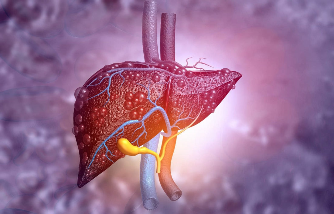 La Hepatitis, enfermedad silente que puede desencadenar una cirrosis hepática.
