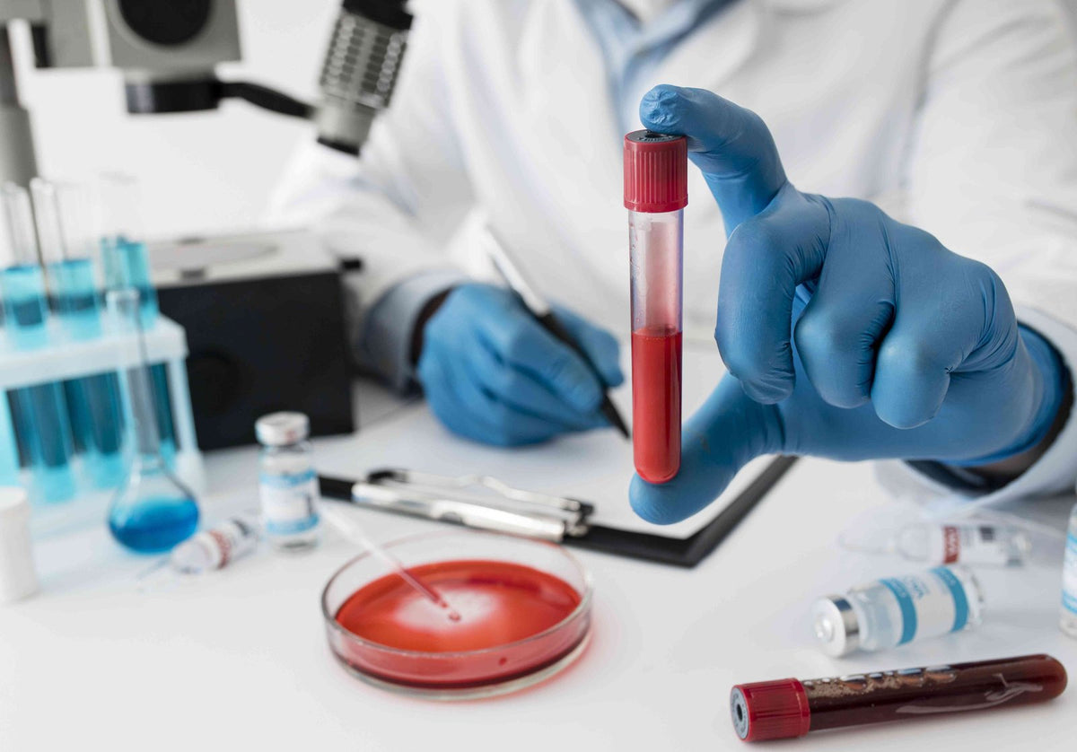 Vsg Lab ¿Qué es la prueba velocidad de sedimentación globular? – Policlinica ...
