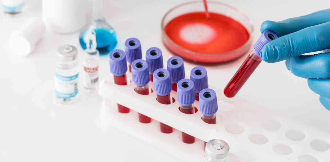 hematología completa
