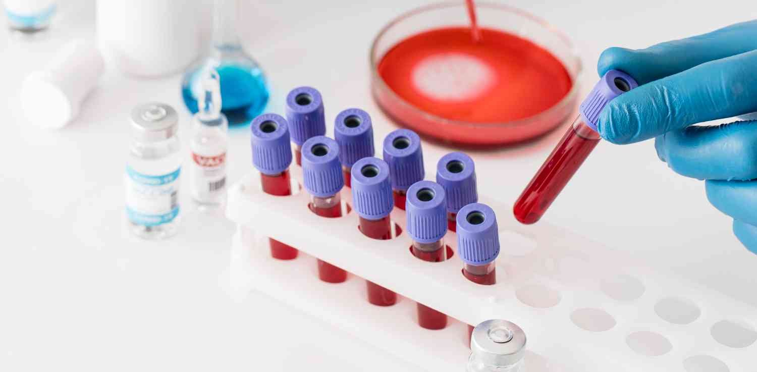 hematología completa