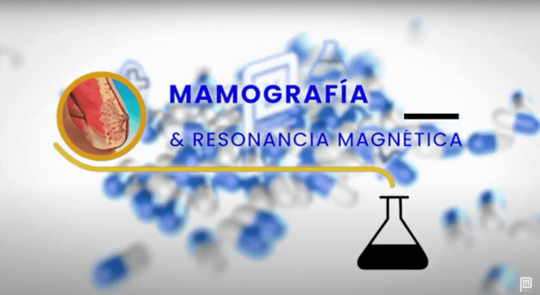 ¿Cuándo realizar una mamografía y resonancia magnética?
