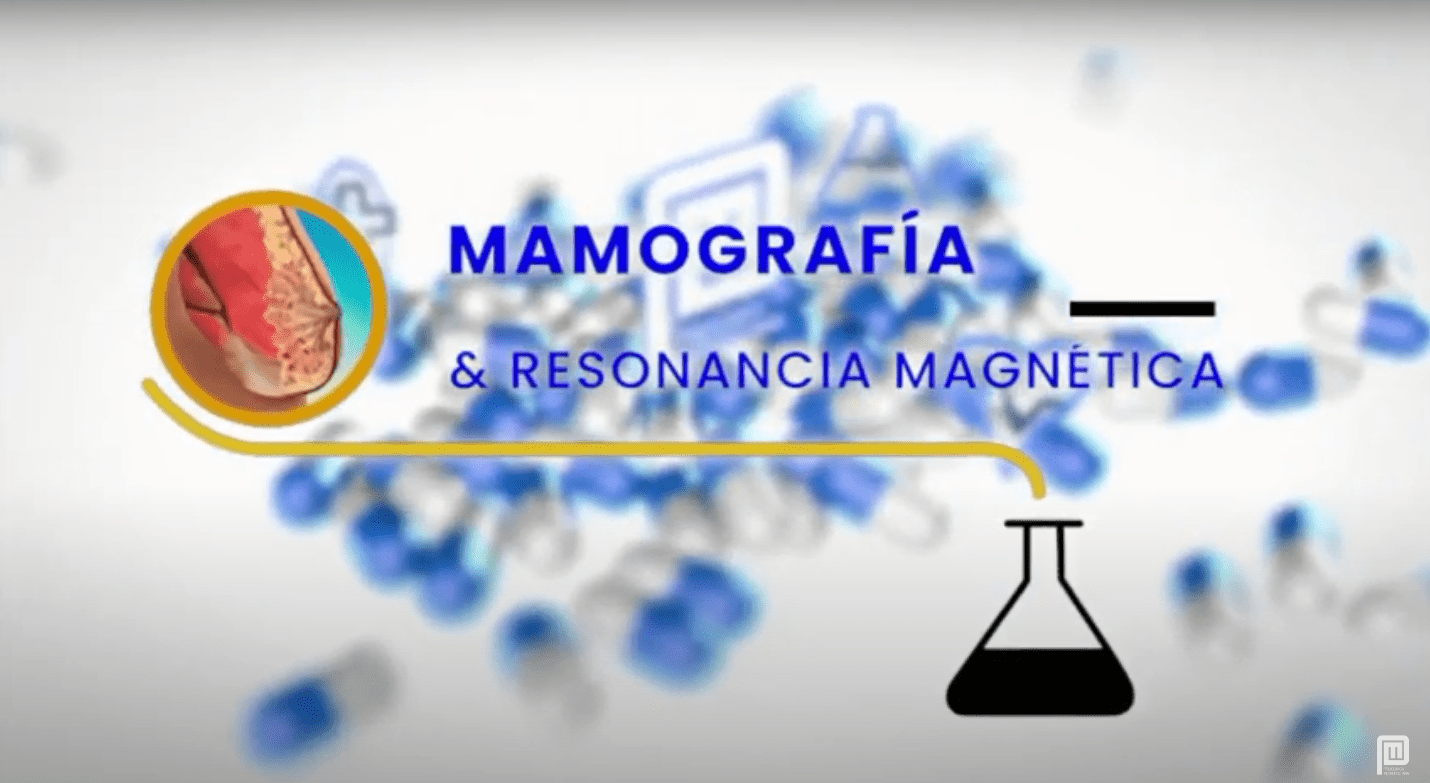 ¿Cuándo realizar una mamografía y resonancia magnética?