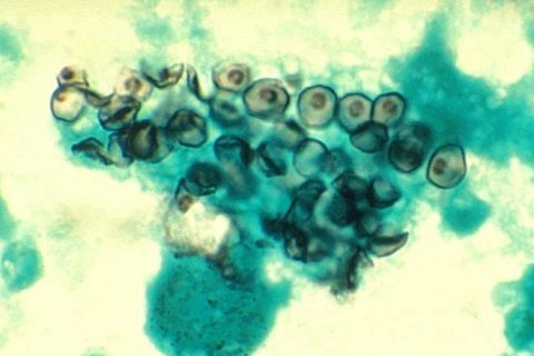 En la imagen se observa un hongo, visto desde el microscopio.