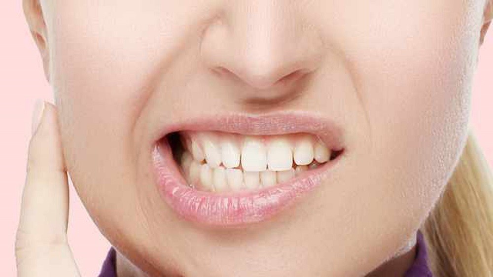 Bruxismo o rechinar los dientes durante la noche: por qué sucede y cómo se  trata