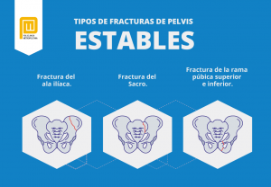 Tipos de Fracturas de Pelvis