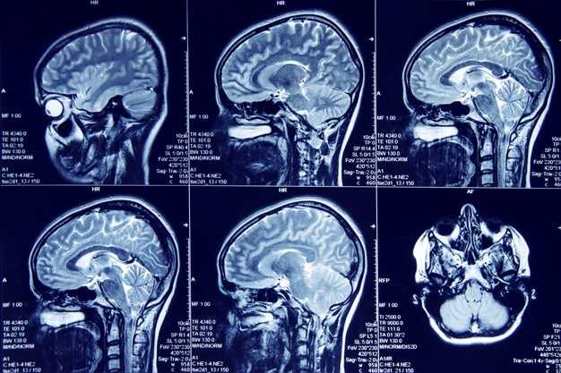 Cómo luce una tomografía cerebral