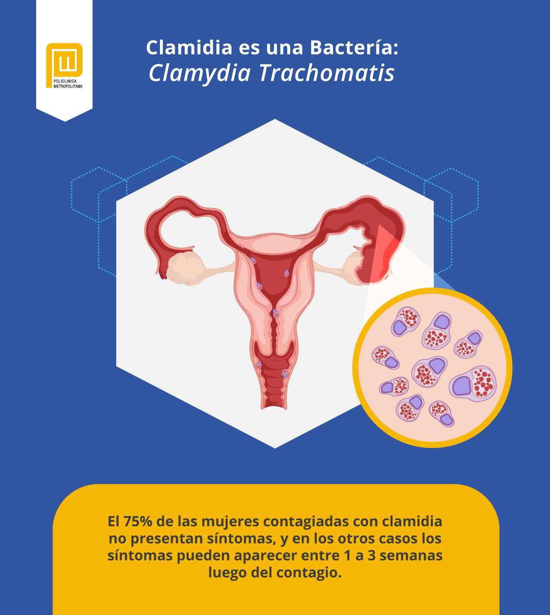La clamidia afecta el aparato reproductor de la mujer
