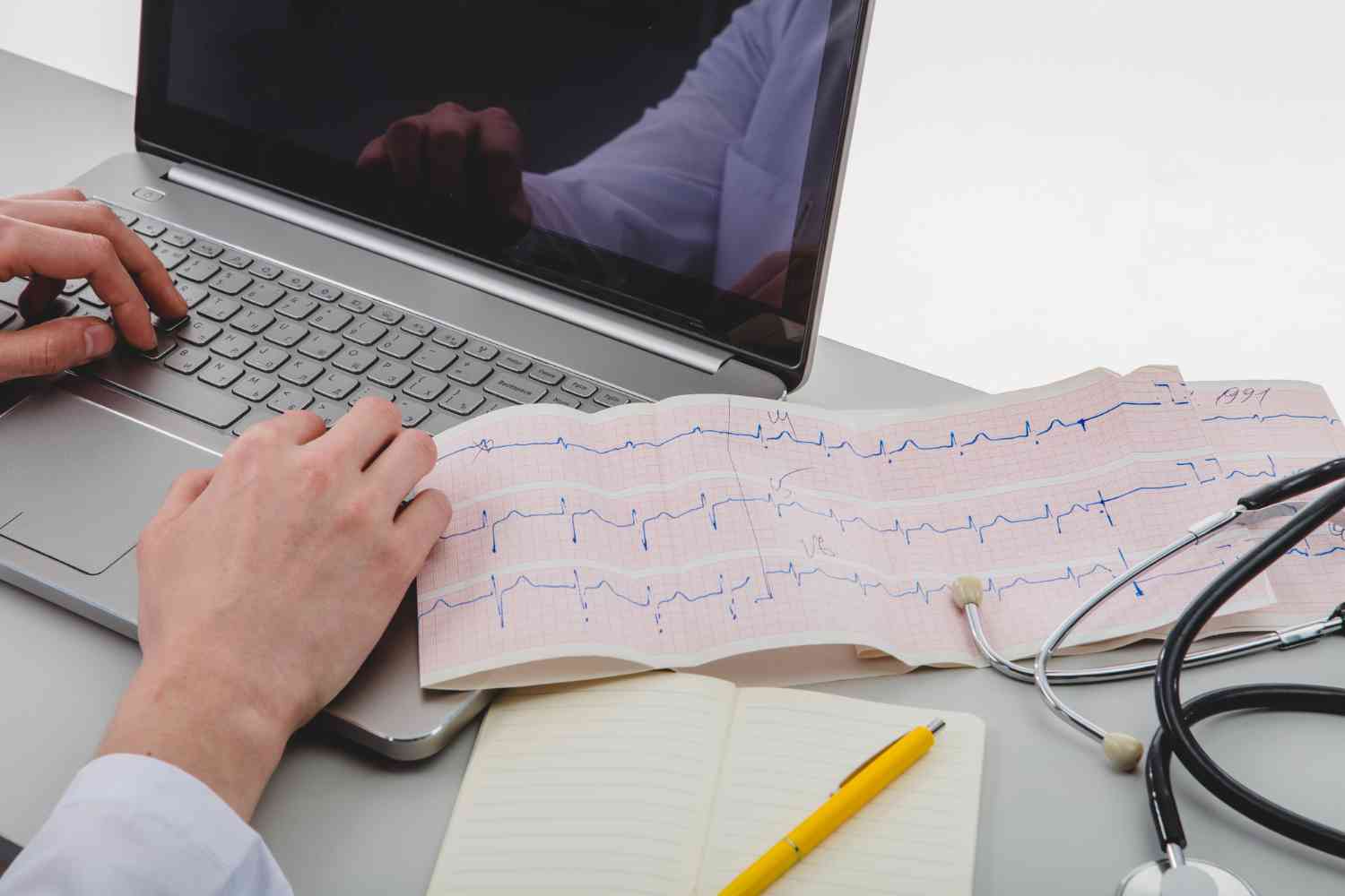 Análisis de monitor Holter