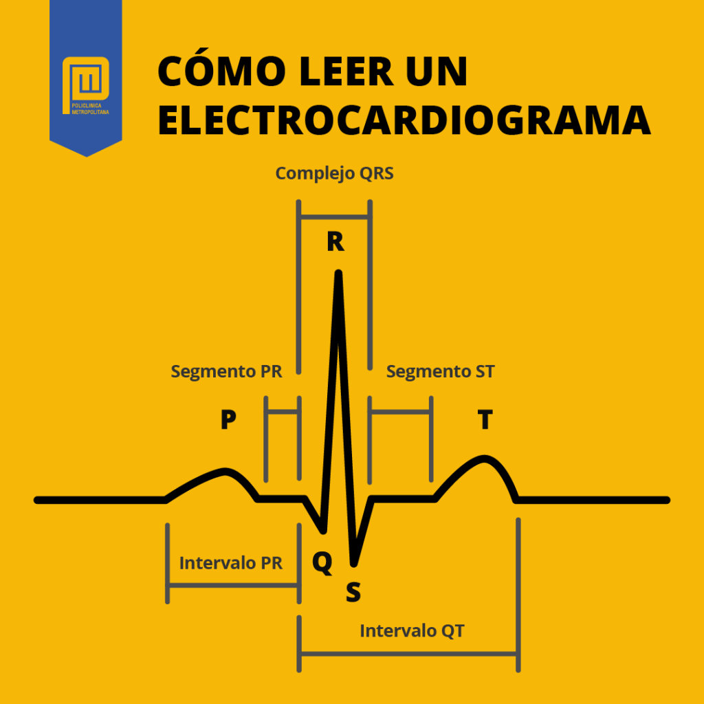 Electrocardiograma ¿qué Es Y Cómo Saber Cuándo Se Necesita 8622