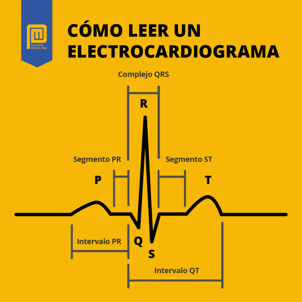 Papel Del Electrocardiograma Como Leer Un Ekg Paso A Paso – NBKomputer