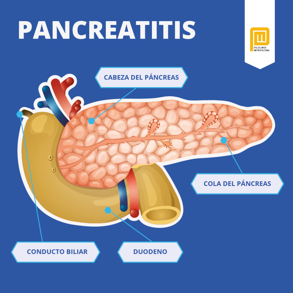 Qu Es La Pancreatitis Tratamientos Y S Ntomas Policl Nica   PCM Pancreatitis 2024 1024x1024 